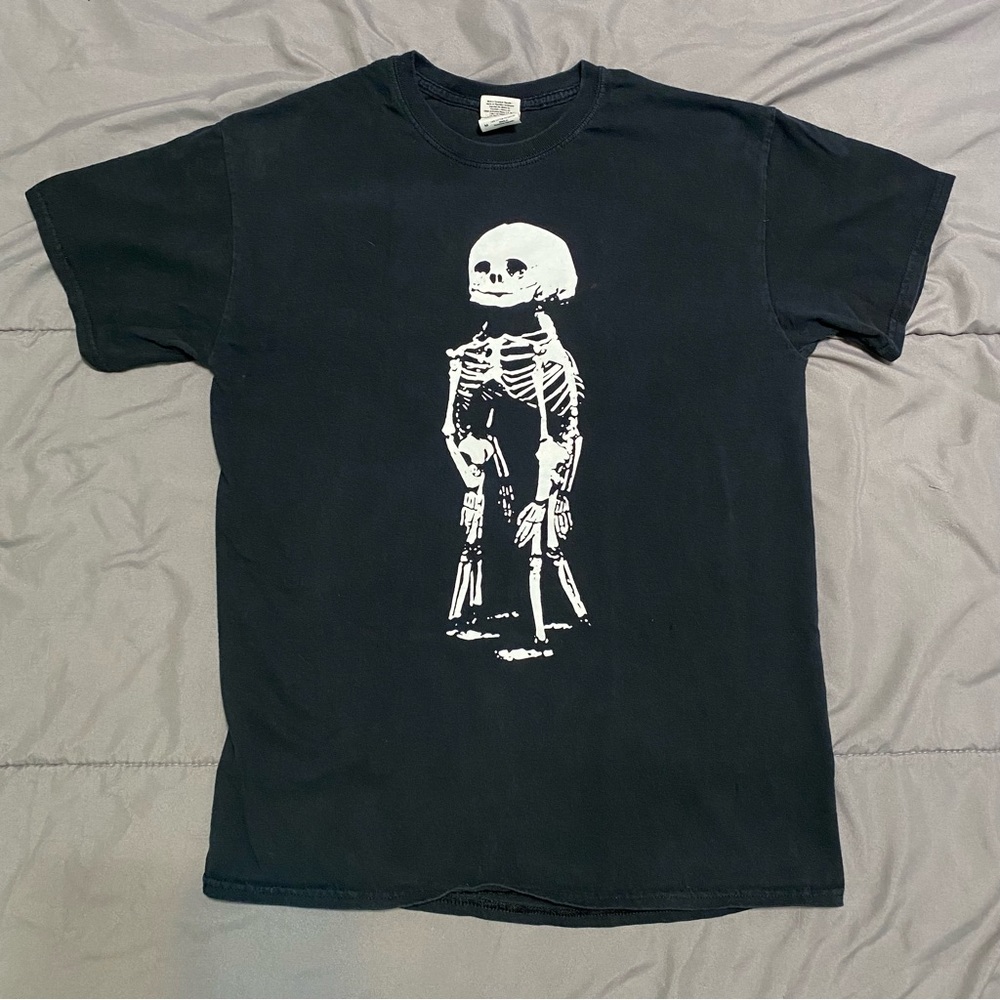 Conjoined Twin Skeleton Tee